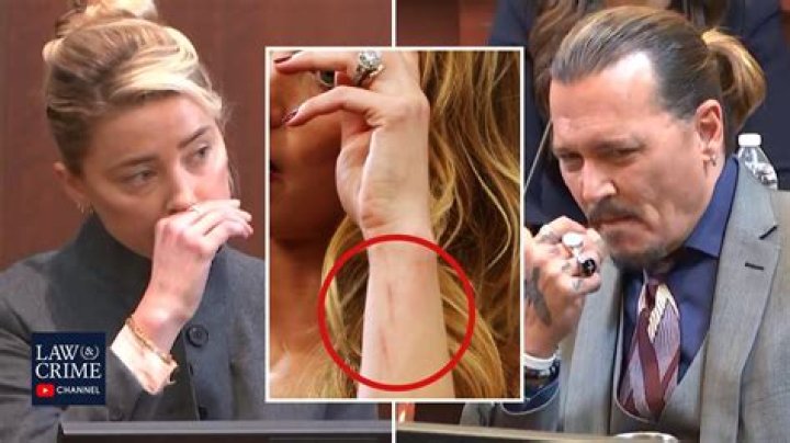 
Amber Heard Scars On Red Carpet Explained: Did Johnny Depp Attack Her? 
