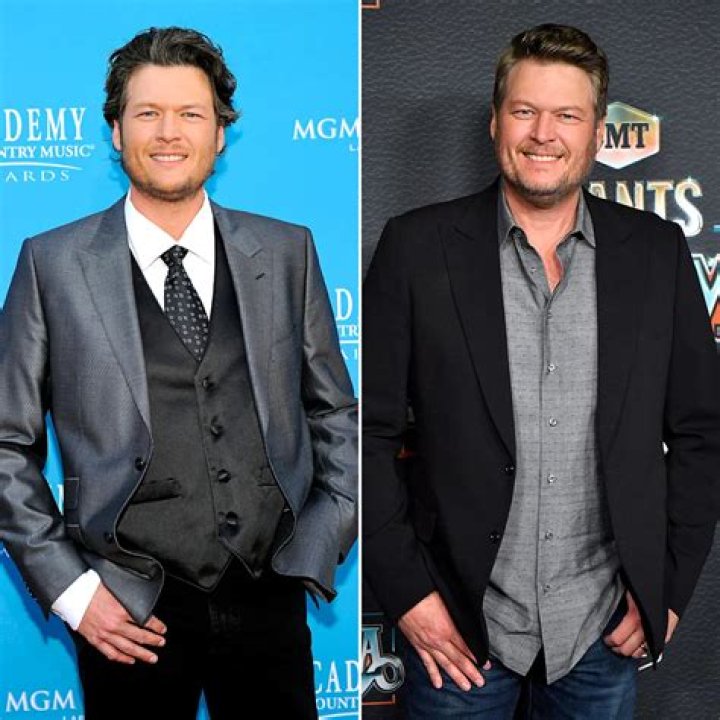 
Blake Shelton Weight Loss Journey – Before And After Photos, Diet And Workout 