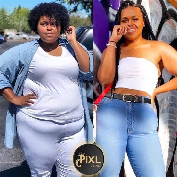 
Cyan Boujee Before Surgery Pictures: What Did She Do? Boyfriend And Net Worth 