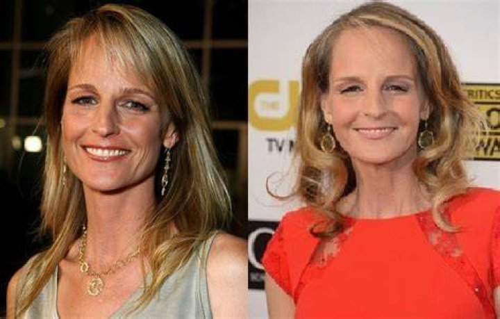Did Helen Hunt Really Get Plastic Surgery and Botox? See Her Before and After Photos