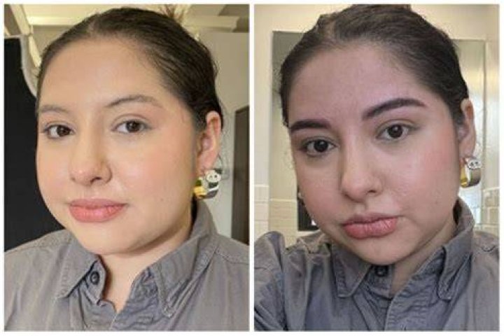 Did Mikhaila Peterson Ever Undergo Plastic Surgery? Before And After Pics Of The Podcaster