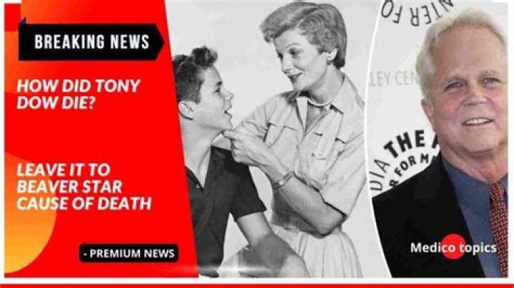 
Tony Dow Obituary, What was Tony Dow Cause of Death? 