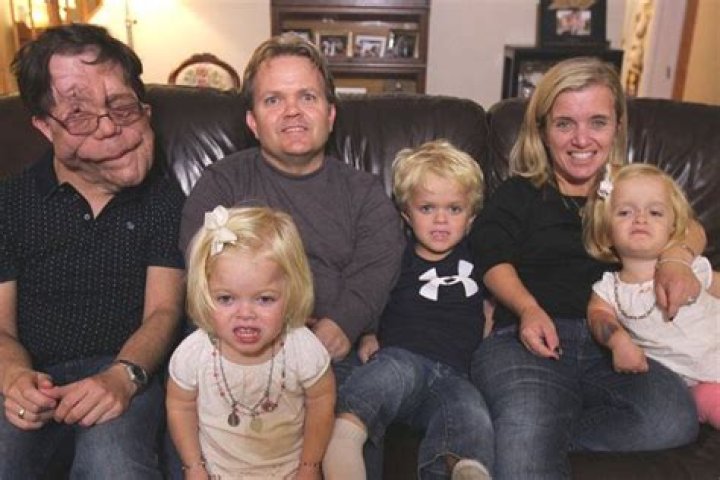 Who Is Adam Pearson’s Brother, Neil Pearson? Family Background Explored